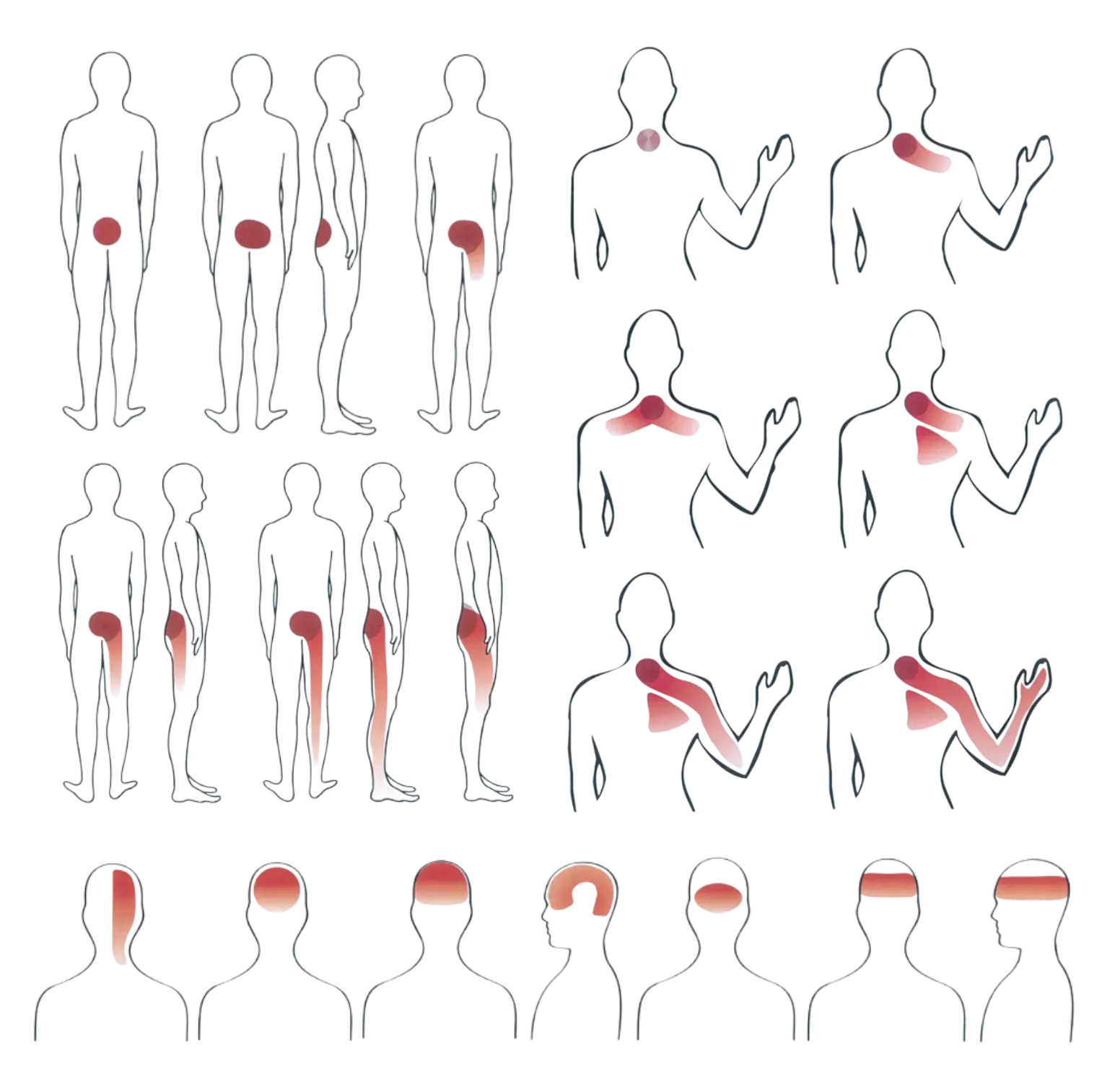 Pain centralization and peripheralization diagram — left columns show back/leg pain moving toward the spine (improving) or spreading further (worsening); right columns show neck/arm pain doing the same; bottom row shows headache patterns